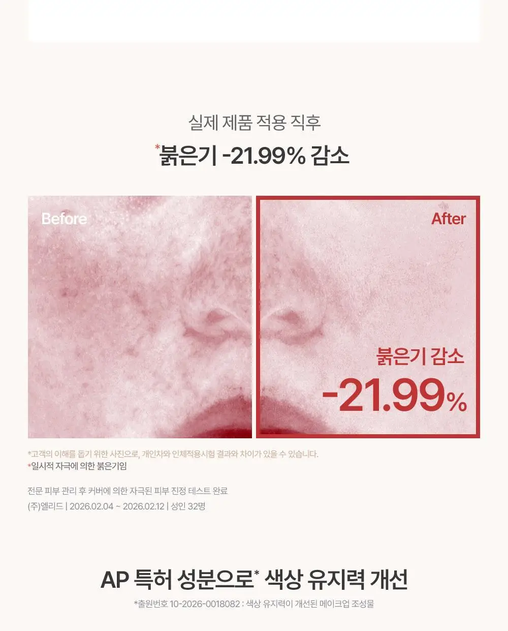 [에스트라 공동개발/5월 올영픽] 에스쁘아 더마커버 블레미쉬 밤 40g 2colors (+에스트라 클렌징폼) 상세페이지 23